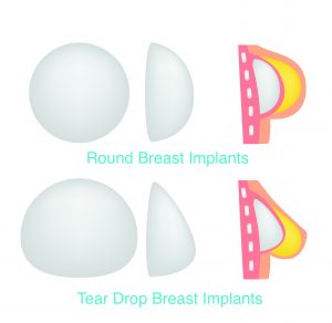 Different Types of Breast Implants - Round vs Tear Drop Implants