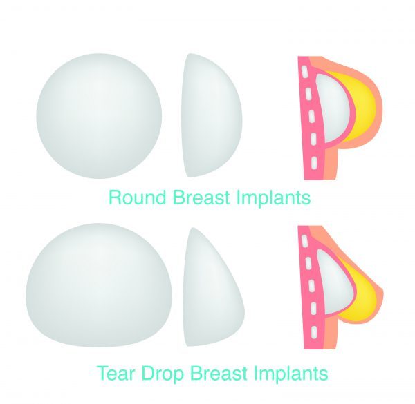 Different Types of Breast Implants Round vs Tear Drop Implants